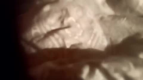 moos1 online show from 02-28-26, 09:05