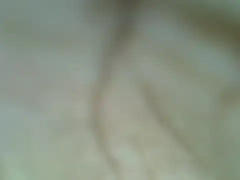 Night nurse 1 online show from 07-13-26, 10:12