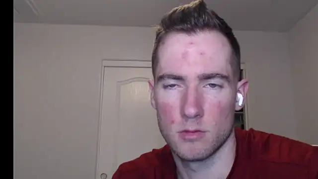 rawdawgrex online show from 03-07-26, 07:16